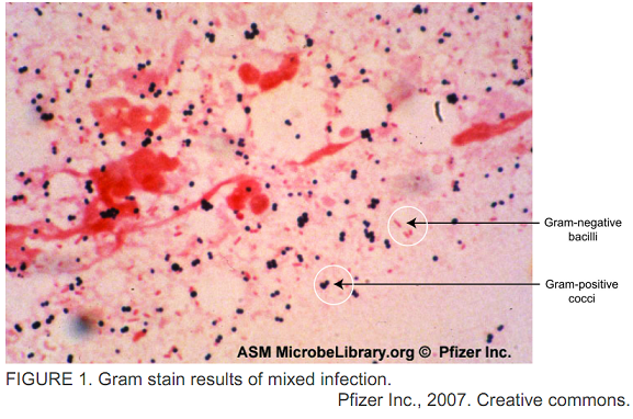 2488_Gram Stain results of mixed infection.png